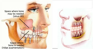 Maxillofacial & Facial Plastic