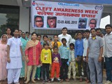 Cleft Awareness Week