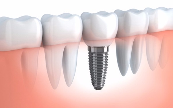 Dental Surgery